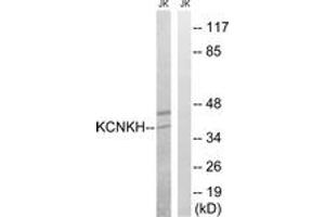 Western Blotting (WB) image for anti-Potassium Channel, Subfamily K, Member 17 (KCNK17) (AA 271-320) antibody (ABIN2890517) (KCNK17 anticorps  (AA 271-320))