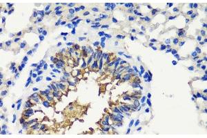 Immunohistochemistry of paraffin-embedded Mouse lung using FKBP1A Polyclonal Antibody at dilution of 1:200 (40x lens). (FKBP1A anticorps)