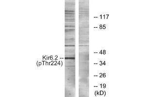 Western blot analysis of extracts from HeLa cells, using Kir6. (KCNJ11 anticorps  (pThr224))