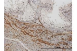 Immunoperoxidase of monoclonal antibody to NKIRAS1 on formalin-fixed paraffin-embedded human prostate.