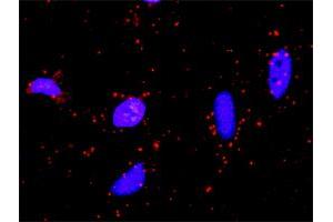 Proximity Ligation Analysis of protein-protein interactions between STK36 and SUFU.