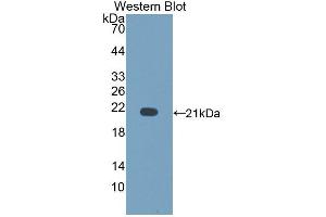 Detection of Recombinant CD164, Rat using Polyclonal Antibody to Cluster Of Differentiation 164 (CD164) (CD164 anticorps  (AA 24-160))