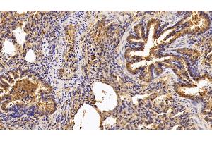 Detection of F8 in Porcine Lung Tissue using Polyclonal Antibody to Coagulation Factor VIII (F8)