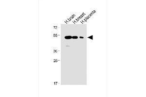 All lanes : Anti-ENT1 Antibody (C-term) at 1:1000 dilution Lane 1: Human brain lysate Lane 2: Human breast lysate Lane 3: Human placenta lysate Lysates/proteins at 20 μg per lane.