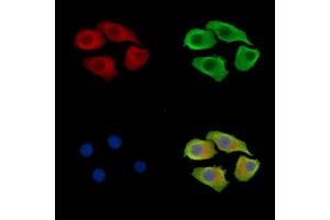 ABIN7095965 and ABIN7100027 staining Hela cells by IF/ICC. (SNX12 anticorps)