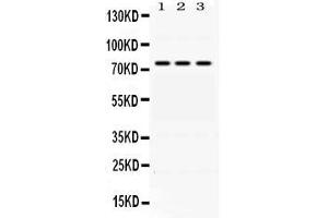 Western blot analysis of ACSL1 expression in rat liver extract ( Lane 1) HEPA whole cell lysates ( Lane 2) and A549 whole cell lysates ( Lane 3). (ACSL1 anticorps  (AA 604-698))
