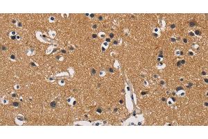 Immunohistochemistry of paraffin-embedded Human brain tissue using CBY1 Polyclonal Antibody at dilution 1:60 (CBY1/PGEA1 anticorps)