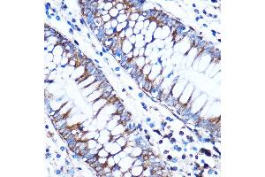 Immunohistochemistry of paraffin-embedded Human colon using CTGF Rabbit pAb (ABIN6127717, ABIN6139188, ABIN6139191 and ABIN6215222) at dilution of 1:100 (40x lens). (CTGF anticorps  (AA 27-349))