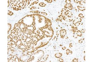 Immunohistochemistry (IHC) image for anti-Androgen Receptor (AR) (AA 1-50) antibody (ABIN7795785) (Recombinant Androgen Receptor anticorps  (AA 1-50))