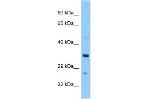Host:  Rabbit  Target Name:  PSG2  Sample Tissue:  Human Breast Tumor  Antibody Dilution:  1ug/ml (PSG2 anticorps)