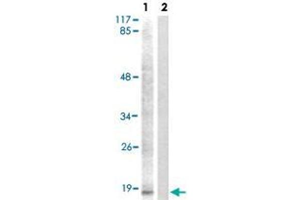 HIST1H3E antibody  (pSer28)