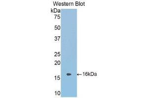 Western Blotting (WB) image for anti-serpin Peptidase Inhibitor, Clade A (Alpha-1 Antiproteinase, Antitrypsin), Member 6 (SERPINA6) (AA 268-391) antibody (ABIN1858272)