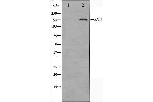 Western blot analysis on HeLa cell lysate using RON Antibody.