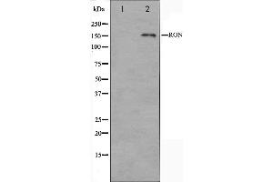 Western blot analysis on HeLa cell lysate using RON Antibody. (MST1R anticorps  (C-Term))