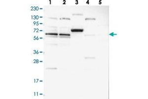 ZNF324B anticorps