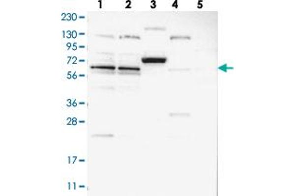 ZNF324B anticorps