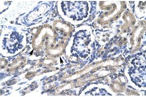 Human kidney; TRAFD1 antibody - C-terminal region in Human kidney cells using Immunohistochemistry (TRAFD1 anticorps  (C-Term))