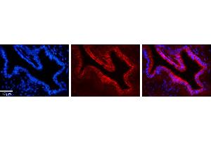 Rabbit Anti-UMPS Antibody     Formalin Fixed Paraffin Embedded Tissue: Human Bronchial Epithelial Tissue  Observed Staining: Cytoplasmic  Primary Antibody Concentration: 1:100  Other Working Concentrations: 1/600  Secondary Antibody: Donkey anti-Rabbit-Cy3  Secondary Antibody Concentration: 1:200  Magnification: 20X  Exposure Time: 0. (UMPS anticorps  (C-Term))