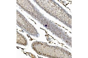 IHC analysis of CCNB1 using anti-CCNB1 antibody (ABIN7599335). (Cyclin B1 anticorps  (AA 1-383))