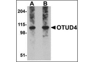 Western blot analysis of OTUD4 in Daudi cell lysate with this product at (A) 0. (OTUD4 anticorps  (C-Term))