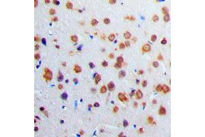 Immunohistochemical analysis of Adenylate Cyclase 1 staining in human brain formalin fixed paraffin embedded tissue section.