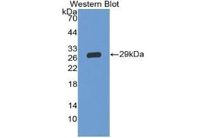 Detection of Recombinant GP5, Human using Polyclonal Antibody to Cluster of Differentiation 42d (CD42d) (GP5 anticorps  (AA 17-242))