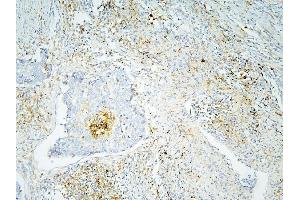 IHC analysis of ANXA3 using anti-ANXA3 antibody (ABIN6719269). (Annexin A3 anticorps  (AA 23-323))