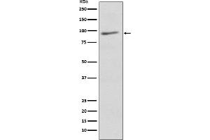 Western blot analysis of EIF2C3 expression in Human brain lysate.