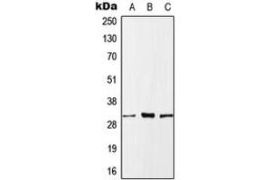 Western blot analysis of MLF1 expression in HeLa (A), SP2/0 (B), H9C2 (C) whole cell lysates. (MLF1 anticorps  (Center))