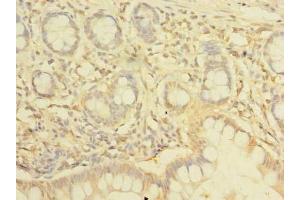 Immunohistochemistry of paraffin-embedded human small intestine tissue using ABIN7161555 at dilution of 1:100 (NHLRC2 anticorps  (AA 1-367))