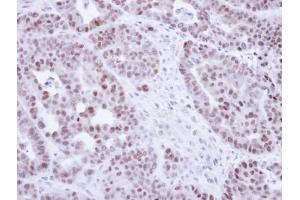 IHC-P Image Immunohistochemical analysis of paraffin-embedded NCIN87 Xenograft, using NR2C2, antibody at 1:100 dilution.