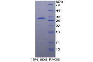 SDS-PAGE (SDS) image for Protein tyrosine Phosphatase, Receptor Type, J (PTPRJ) (AA 1061-1293) protein (His tag) (ABIN1879105)