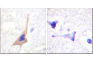 Immunohistochemistry analysis of paraffin-embedded human brain, using Tryptophan Hydroxylase (Phospho-Ser58) Antibody.