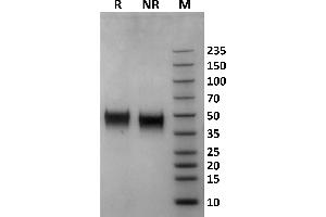 Human Fc gamma RIIIb / CD16b (NA1) protein on Coomassie Blue stained SDS-PAGE under non-reducing (NR) and reducing (R) conditions.