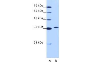WB Suggested Anti-EXOSC7 Antibody Titration:  1. (EXOSC7 anticorps  (N-Term))