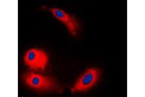 Immunofluorescent analysis of ARMC6 staining in COLO205 cells.