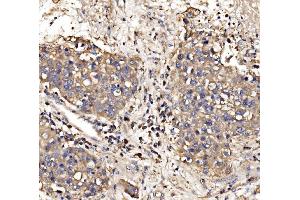 IHC analysis of Gephyrin/GPHN using anti-Gephyrin/GPHN antibody (ABIN7600086). (Gephyrin anticorps  (AA 148-736))