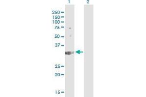 Western Blot analysis of TREX1 expression in transfected 293T cell line by TREX1 monoclonal antibody (M01), clone 2F10.