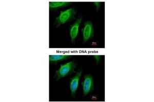ICC/IF Image Immunofluorescence analysis of paraformaldehyde-fixed HeLa, using SH3GL1, antibody at 1:200 dilution. (SH3GL1 anticorps  (Center))