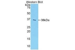 Detection of Recombinant PST, Rat using Polyclonal Antibody to Sulfotransferase 1A1 (SULT1A1)