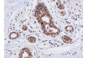 Immunohistochemistry (IHC) image for anti-Cathepsin D (CTSD) (AA 21-412) antibody (ABIN317502) (Cathepsin D anticorps  (AA 21-412))