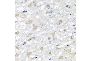 Immunohistochemistry of paraffin-embedded rat brain using RPLP1 antibody at dilution of 1:100 (x40 lens). (RPLP1 anticorps)