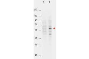 Western Blot of Mouse anti-AKT pT308 antibody. (AKT1 anticorps  (pThr308))