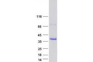 Validation with Western Blot