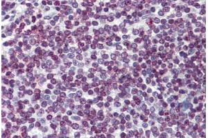 Human Spleen: Formalin-Fixed, Paraffin-Embedded (FFPE) (FOXO3 anticorps  (AA 361-460))