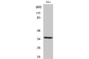 Western Blotting (WB) image for anti-Casein Kinase 1, alpha 1 (CSNK1A1) (Internal Region) antibody (ABIN3183657) (CSNK1A1 anticorps  (Internal Region))