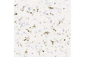 Immunohistochemistry of paraffin-embedded human brain using CD68 antibody (ABIN7266211) at dilution of 1:50 (40x lens). (CD68 anticorps)