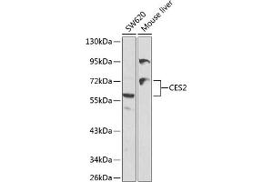 Western blot analysis of extracts of various cell lines, using CES2 antibody (ABIN3022047, ABIN3022048, ABIN3022049 and ABIN6218583) at 1:1000 dilution.