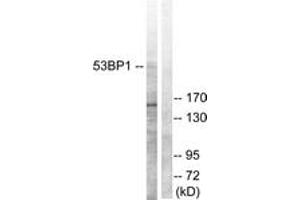 Western blot analysis of extracts from A549 cells, using 53BP1 (Ab-6) Antibody. (TP53BP1 anticorps  (AA 1-50))