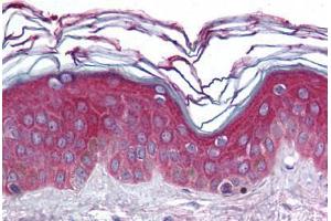 Human Skin (formalin-fixed, paraffin-embedded) stained with ARHGEF11 antibody ABIN296726 at 10 ug/ml followed by biotinylated goat anti-rabbit IgG secondary antibody ABIN481713, alkaline phosphatase-streptavidin and chromogen. (ARHGEF11 anticorps  (AA 1-50))